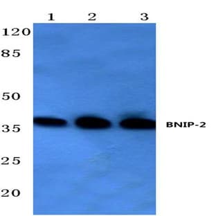 BNIP-2 (E122) pAb avatar