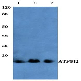 ATP5J2 (G42) pAb avatar