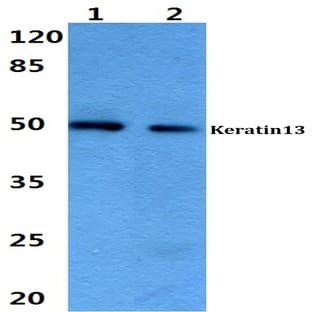 Cytokeratin 13 (E282) pAb avatar