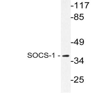 SOCS-1 (V98) pAb avatar
