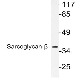 Sarcoglycan-(beta) (V136) pAb avatar