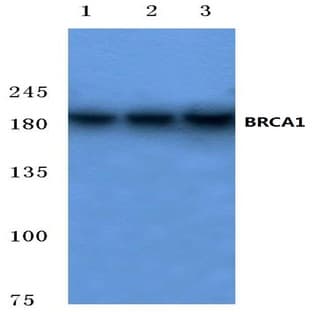 BRCA1 (P982) pAb avatar