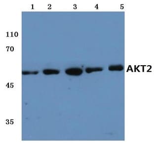 AKT2 (T468) pAb avatar