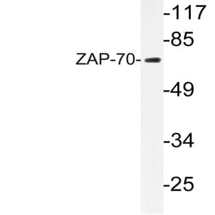 ZAP70 (S313) pAb avatar