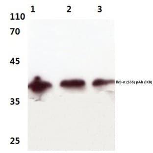 IkB-(alpha) (S36) pAb avatar