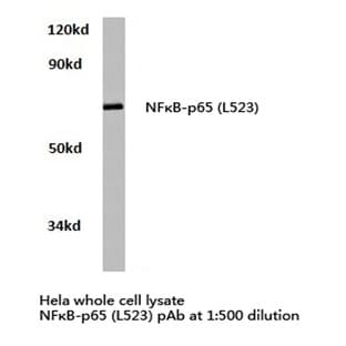 NFkB-p65 (L523) pAb avatar