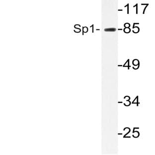 Sp1 (E336) pAb avatar