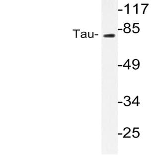 Tau (P206) pAb avatar