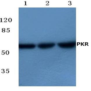 PKR (R445) pAb avatar