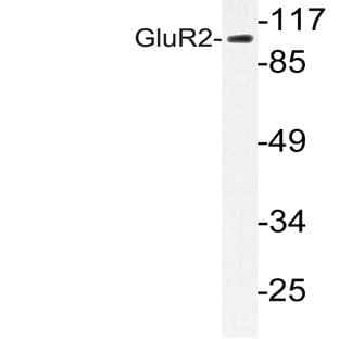 GluR2 (Y873) pAb avatar