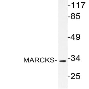 MARCKS (R157) pAb avatar