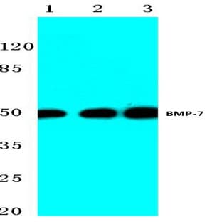 BMP-7 (E173) pAb avatar