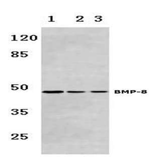BMP-8 (E90) pAb avatar