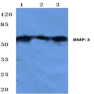 BMP-3 (E306) pAb avatar
