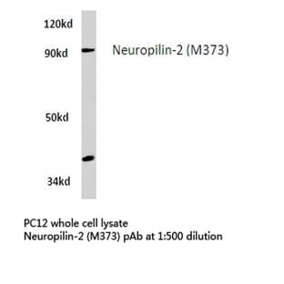 Neuropilin-2 (M373) pAb avatar