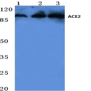 ACE2 (K465) pAb avatar