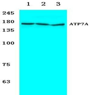 ATP7A (H640) pAb avatar
