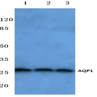 AQP1 (N134) pAb avatar