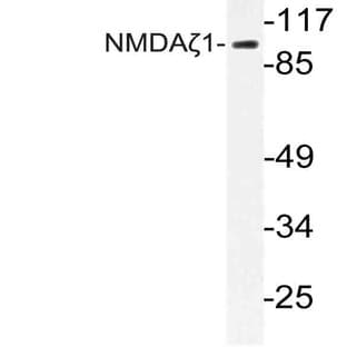 NMDA?1 (F891) pAb avatar