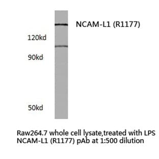 NCAM-L1 (R1177) pAb avatar