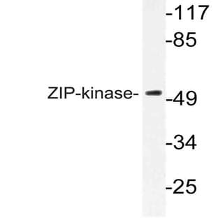 ZIP-kinase (K261) pAb avatar