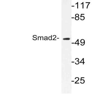 Smad2 (P251) pAb avatar