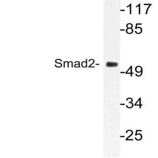 Smad2 (M241) pAb avatar