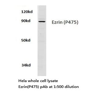Ezrin (P475) pAb avatar