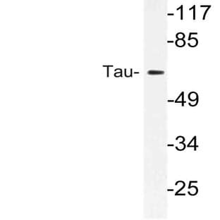 Tau (S527) pAb avatar