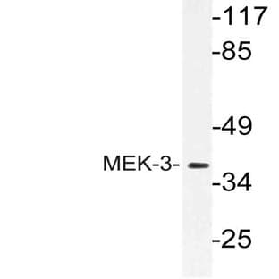 MEK-3 (L215) pAb avatar