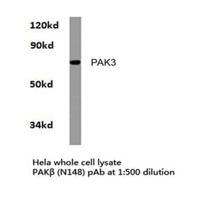 PAK3 (N148) pAb avatar