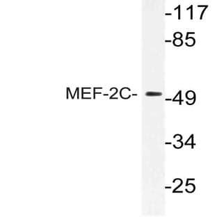 MEF-2C (I390) pAb avatar
