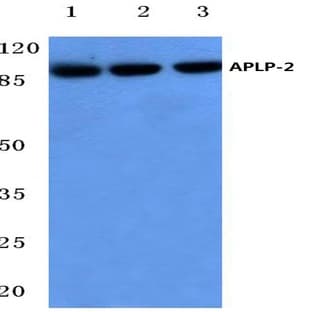 APLP-2 (Y274) pAb avatar