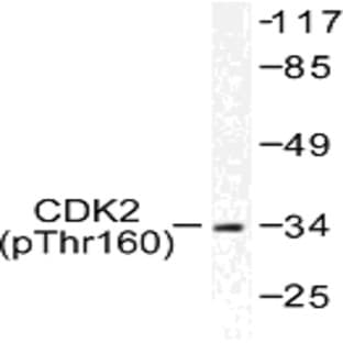 p-Cdk2 (T160) pAb avatar