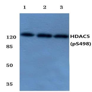 p-HDAC5 (S498) pAb avatar