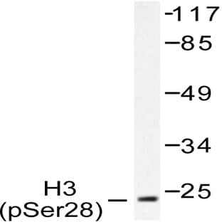 P-Histone H3 (S28) pAb avatar