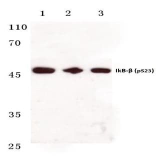 p-IkB-(beta) (S23) pAb avatar