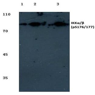 p-IKK(alpha)/(beta) (S176/177) pAb avatar