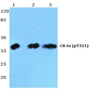p-Casein Kinase I(alpha) (T321) pAb