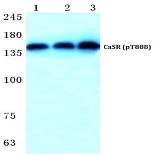 p-CaSR (T888) pAb avatar