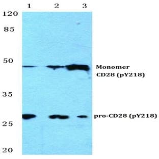 p-CD28 (Y218) pAb avatar