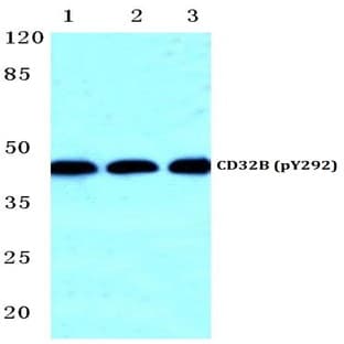 p-CD32-B (Y292) pAb avatar