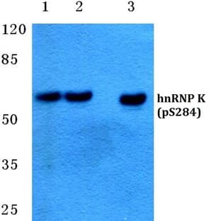p-hnRNP K (S284) pAb avatar