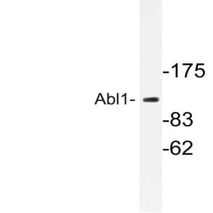 ABL1 (G418) pAb avatar
