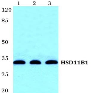 HSD11B1 pAb avatar