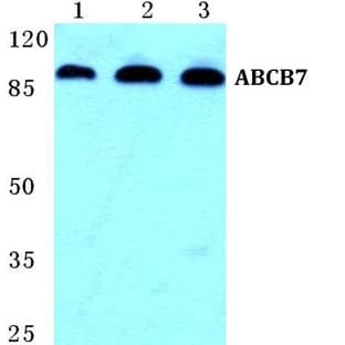 ABCB7 pAb avatar