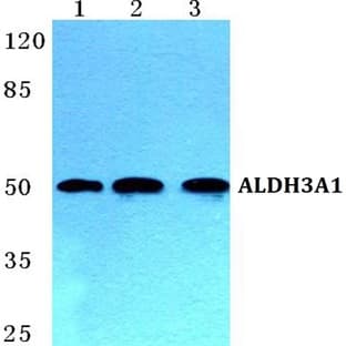 ALDH3A1 pAb avatar