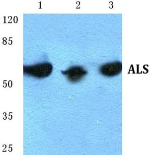 ALS pAb avatar