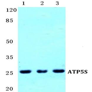 ATP5S pAb avatar
