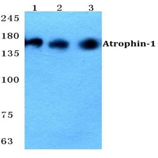 Atrophin-1 pAb avatar